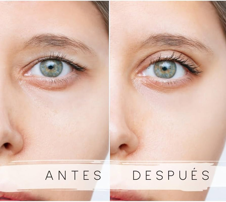 LEVANTAPARPADOS EYELID (120 UNIDADES)
