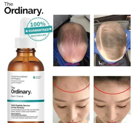 SUERO FORTALCEDOR Y ANTICAIDA - THE ORDINARY